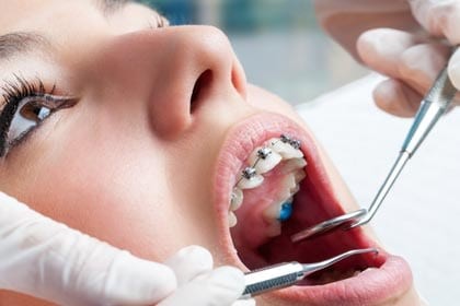 traitement-orthodontie